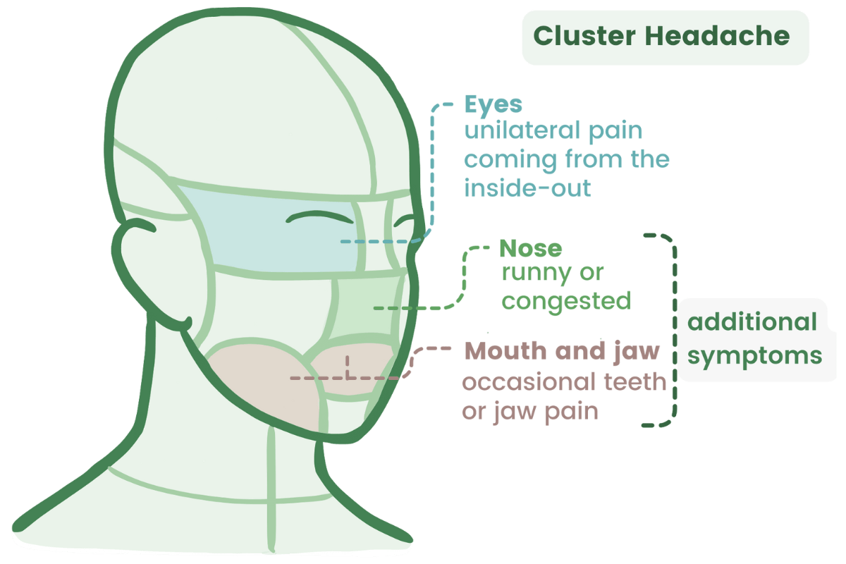 Cluster headache symptoms