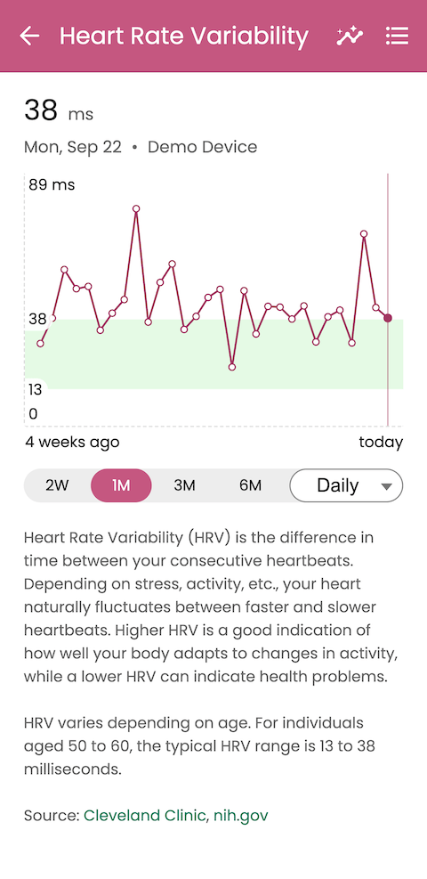 Guava patient app displaying heart rate variability trends from wearables alongside Elation health records