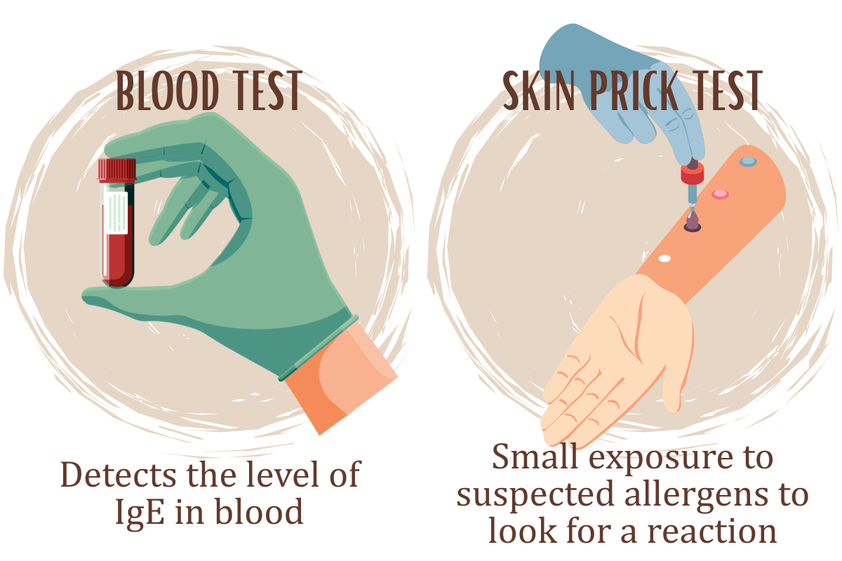A diagram showing 2 ways of diagnosing for food allergies, which are blood test and skin prick test